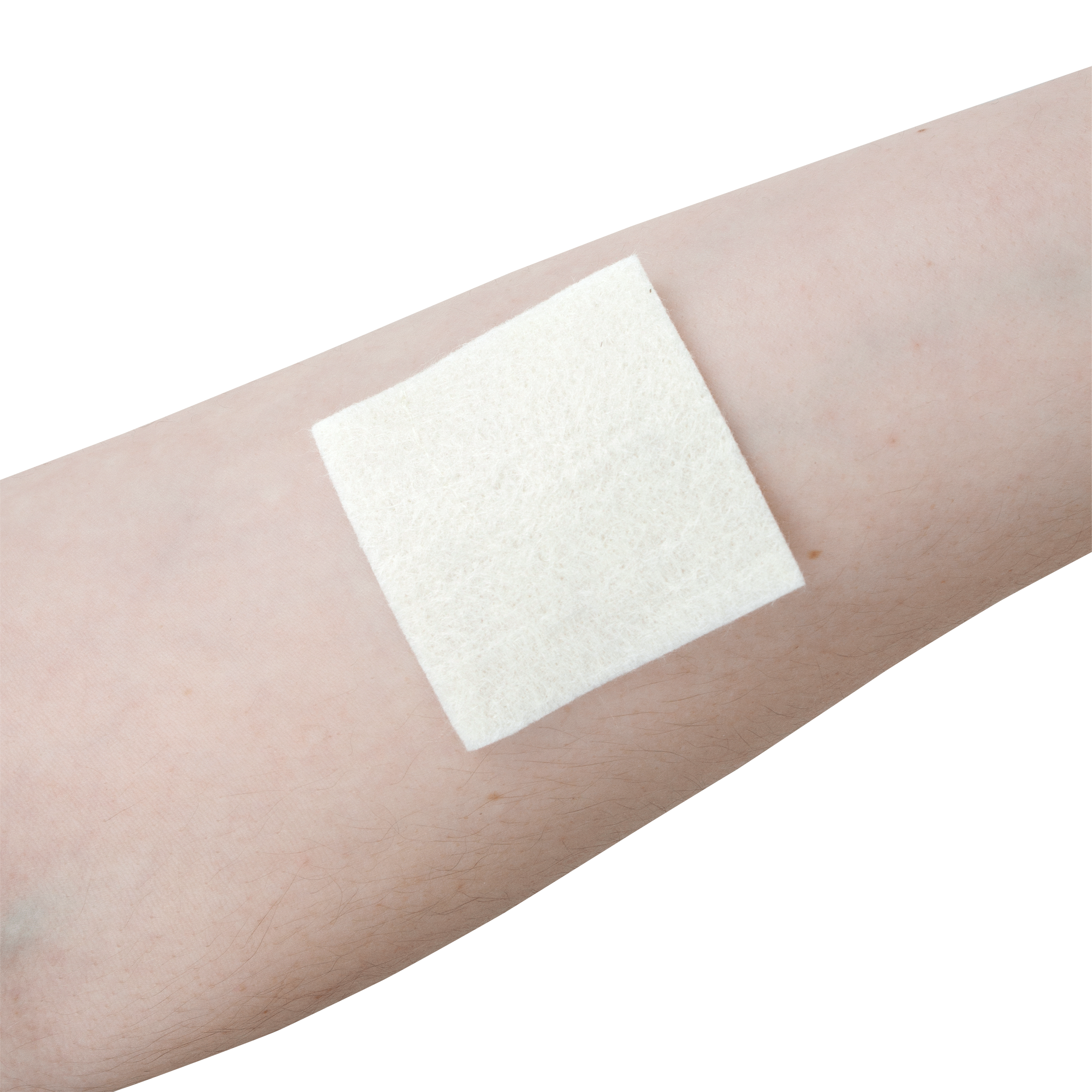 DynaGinate AG - Silver Calcium Alginate Dressing